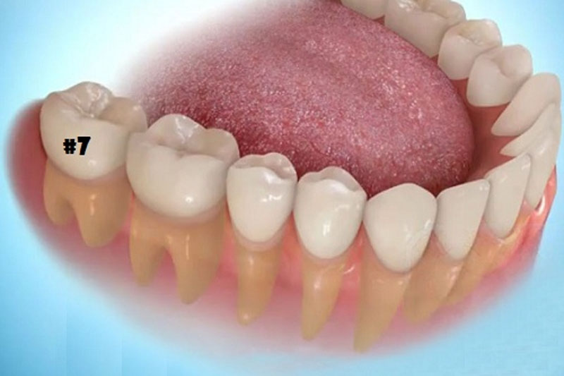 Răng số 7 là răng hàm có chức năng quan trọng trong việc nhai nghiền thức ăn.
