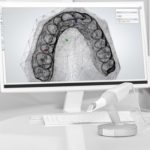 Chụp CT Răng: Phương Pháp, Vai Trò Và Một Số Lưu Ý Thực Hiện