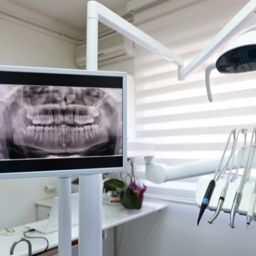 Chụp X-quang răng là công cụ rất quan trọng trong điều trị nha khoa