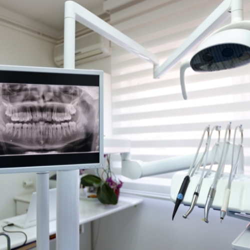 Khám phá chụp X-quang răng ở đâu chất lượng