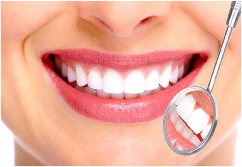 Bọc răng sứ là một trong những giải pháp giúp bảo vệ răng tối ưu hiện nay