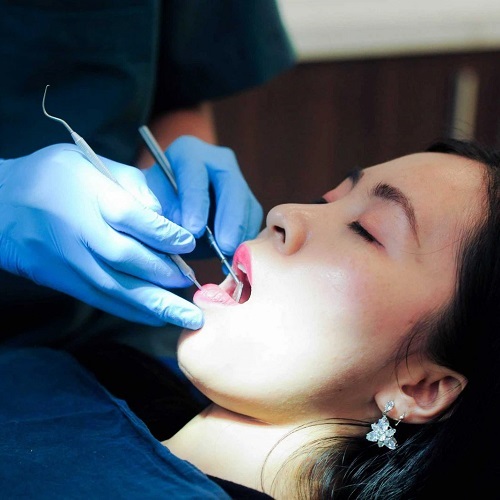Nhổ răng ở địa chỉ kém uy tín có thể gây nhiều ảnh hưởng xấu đến sức khỏe