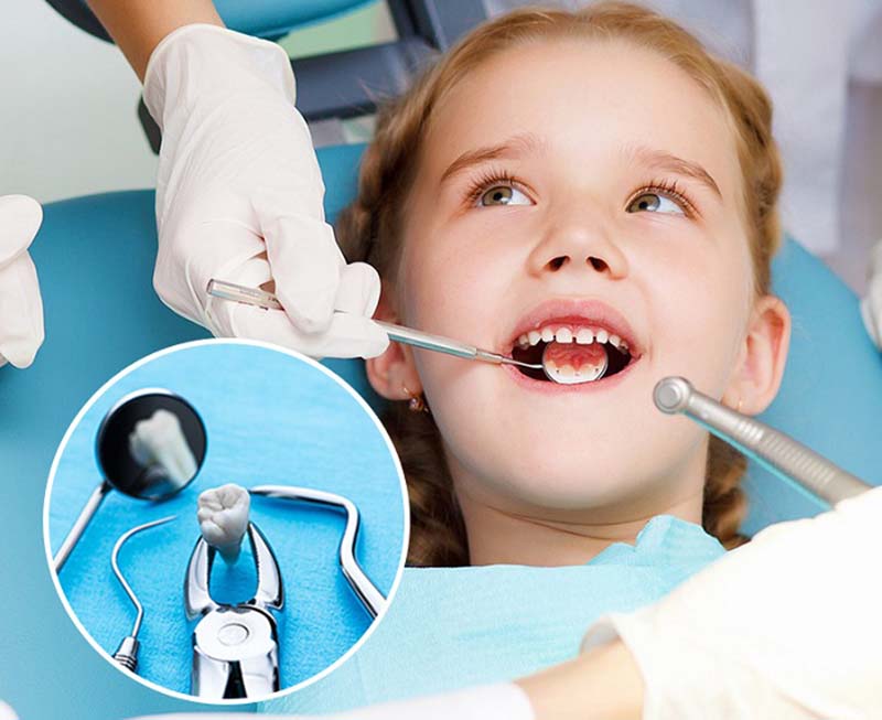 Với trường hợp trẻ có cơ địa nhạy cảm hay mắc các bệnh lý nền, tốt nhất là nên đưa đến nha khoa để nhổ răng