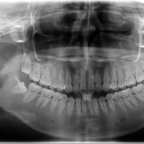 Thăm khám răng và chụp X-quang miệng