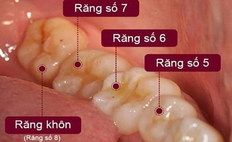 Vị trí của răng số 7 trên cung hàm của người trưởng thành.