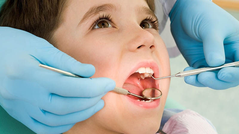 Cách tốt nhất cho trẻ bị sâu răng là đến bệnh viện để được chữa trị đúng cách