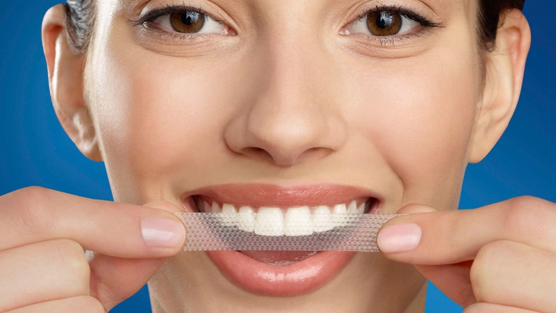 Khi thực hiện phương pháp làm trắng răng tại nhà cần lưu ý cách ly nướu cẩn thận