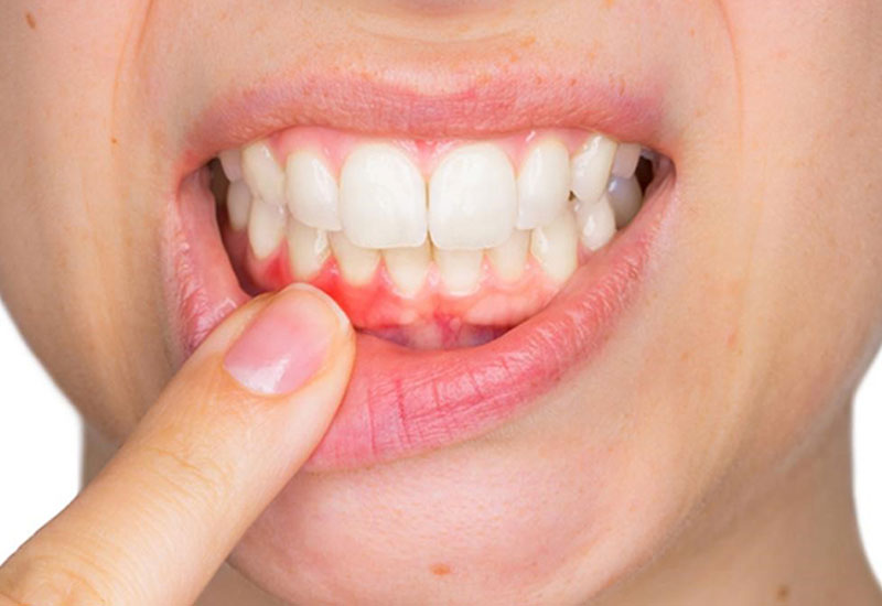 Chỉ định dùng trong điều trị các vấn đề răng miệng